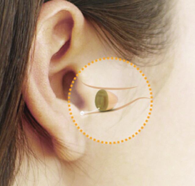 耳内式助听器怎么保养？助听器保养的方法