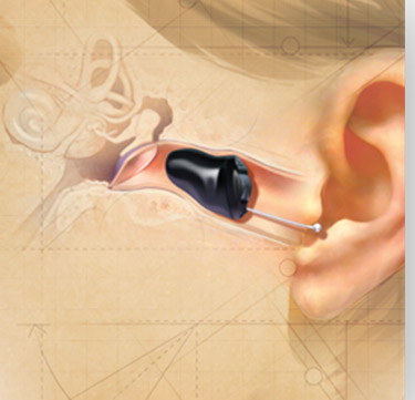 定制机助听器长什么样？定制式助听器有哪些类别
