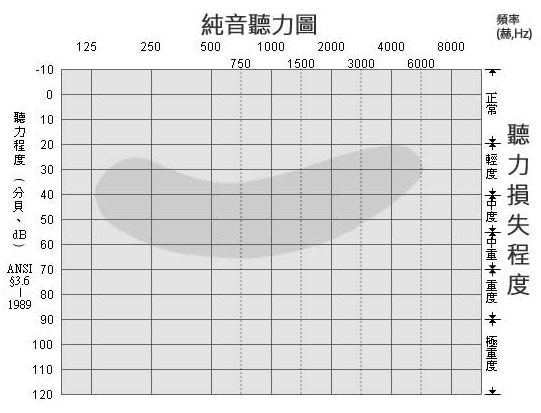 三分钟教您看懂听力测试结果-听力图(图1)