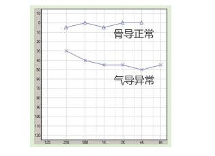 传导性听损的解决办法(图1)